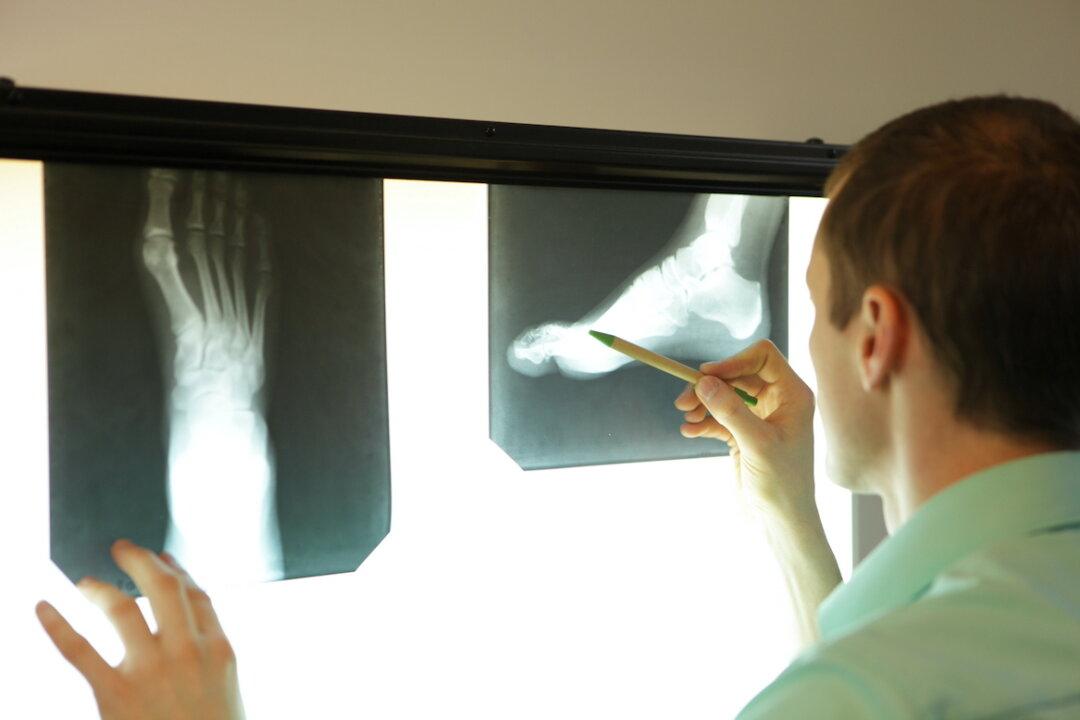 The Sometimes Strange History of the X-Ray
