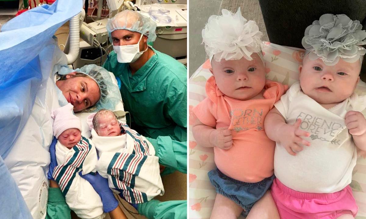 Mom Gives Birth to 1-in-2-Million Twins With Down Syndrome: ‘They Have a Beating Heart, They Do Everything We Do’