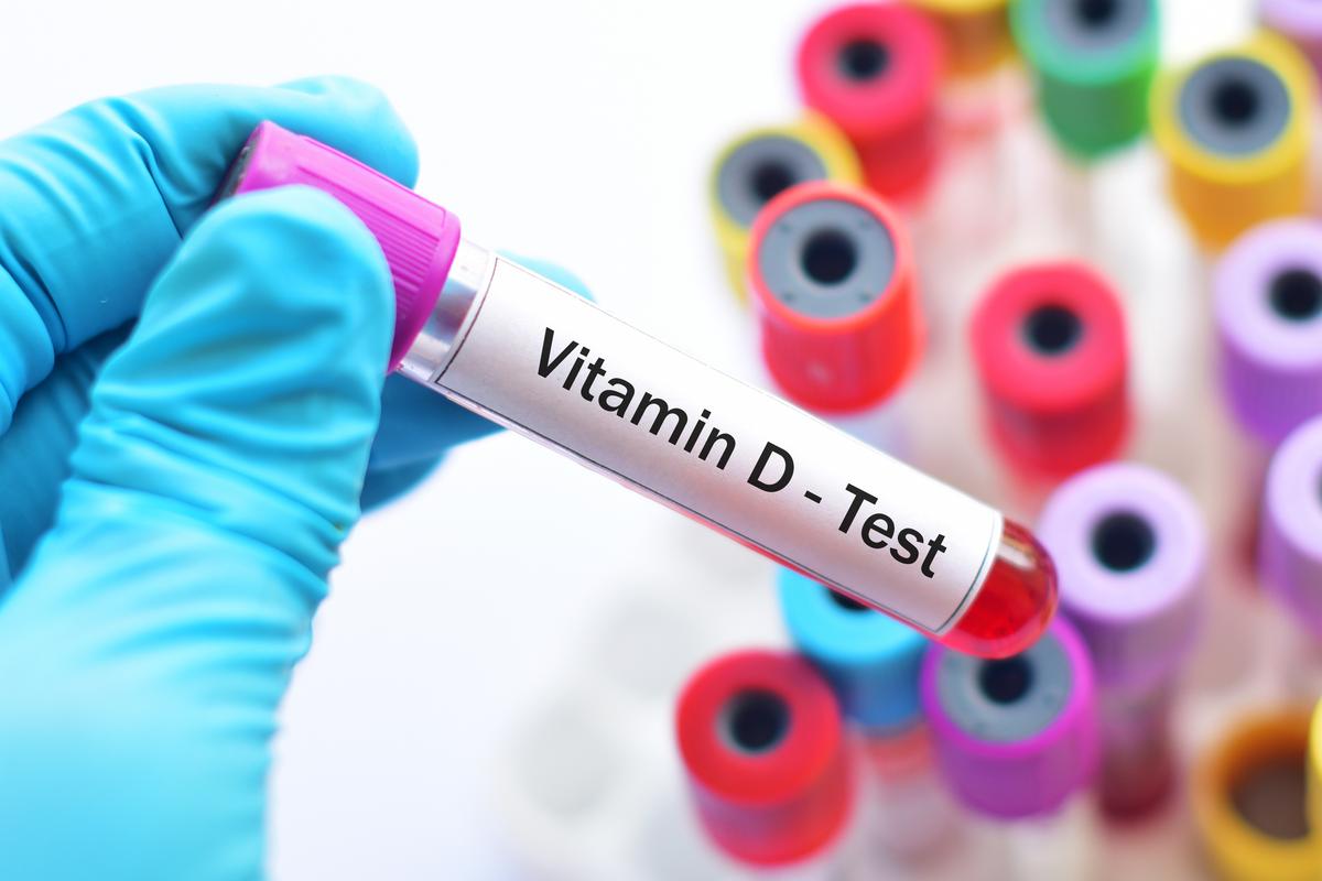 Study Shows Causal Relationship Between Vitamin D Deficiency and Dementia