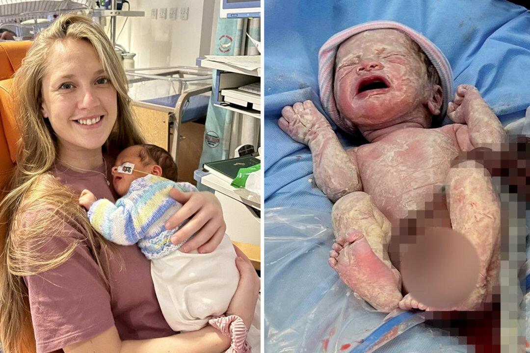 Mom Left in Shock After Her Baby Was Born With Organs Outside His Body Due to a Rare Condition