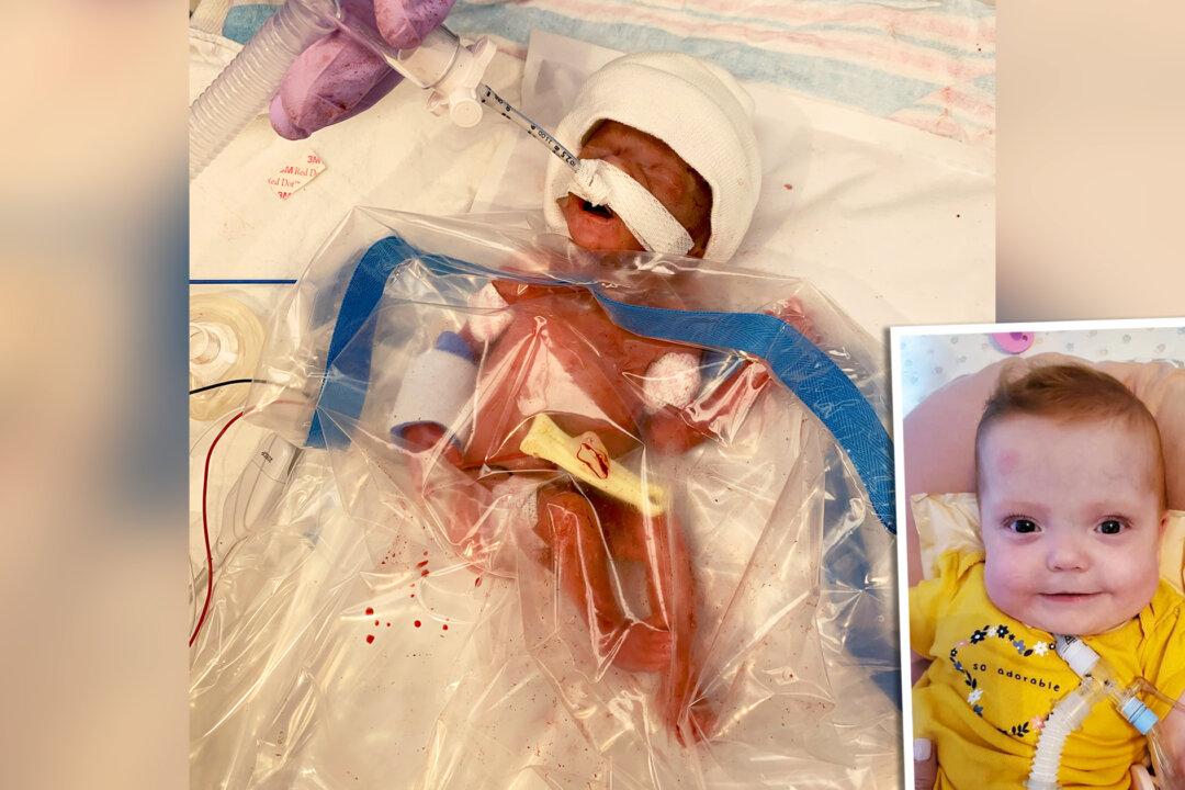 1lb Premature Baby Born at 22 Weeks and Saved by Sandwich Bag Thrives: ‘Little Miracle’