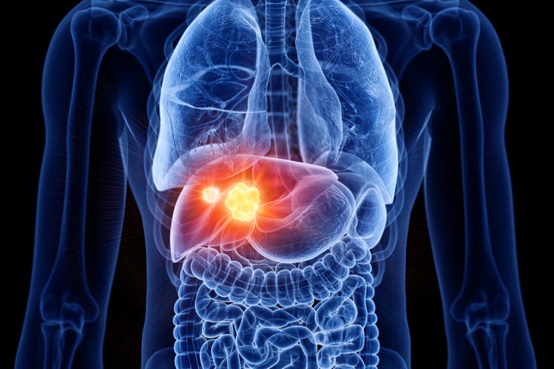 Fatty Liver Disease Affects 1 in 3 Americans: Tips to Reverse It Naturally
