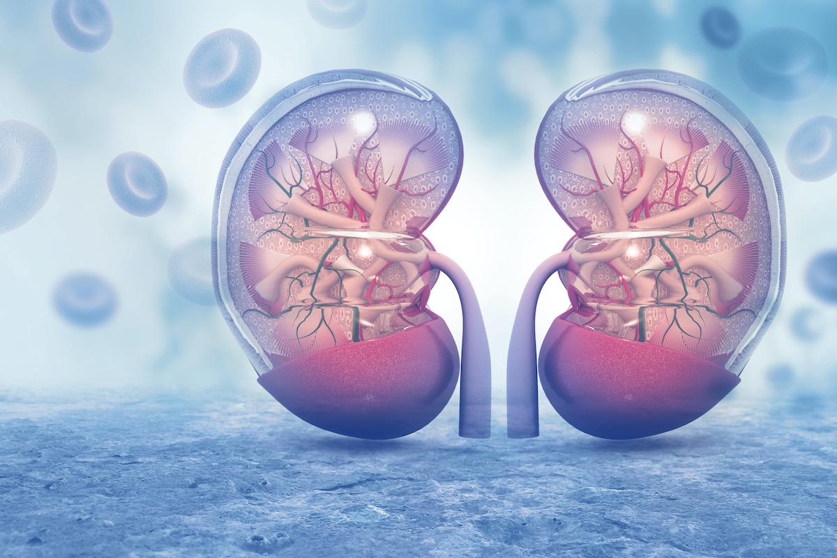 A Cup of Coffee a Day Can Prevent Kidney Stones, If You Drink It Correctly