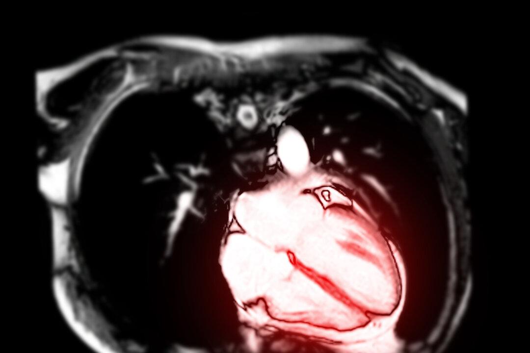 Cardiologist Estimates 30 Percent of US Pilots May Have COVID Jab-Induced Heart Conditions