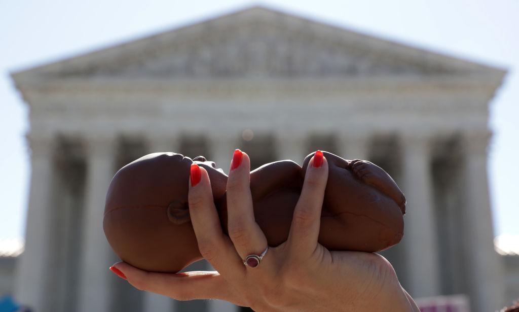 The Value of a Fetus