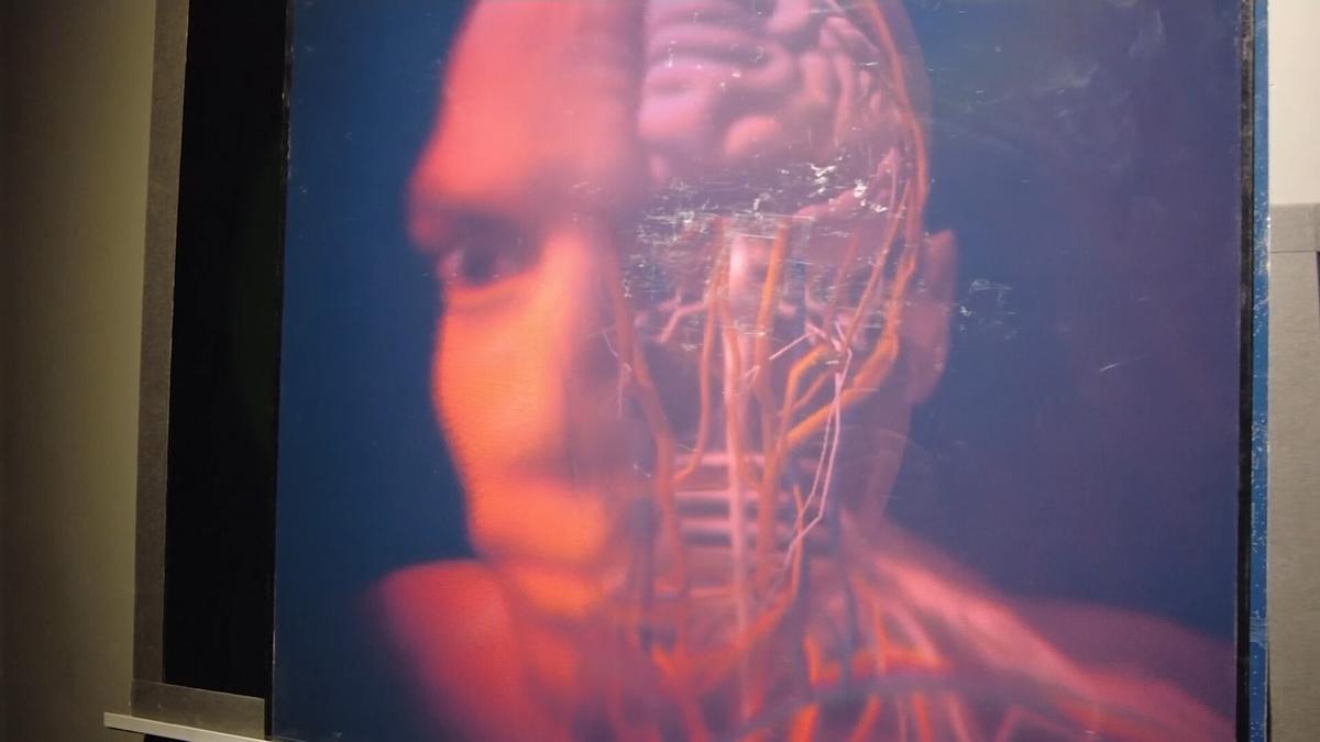 Revival of Hologram Technology for Medicine and Security