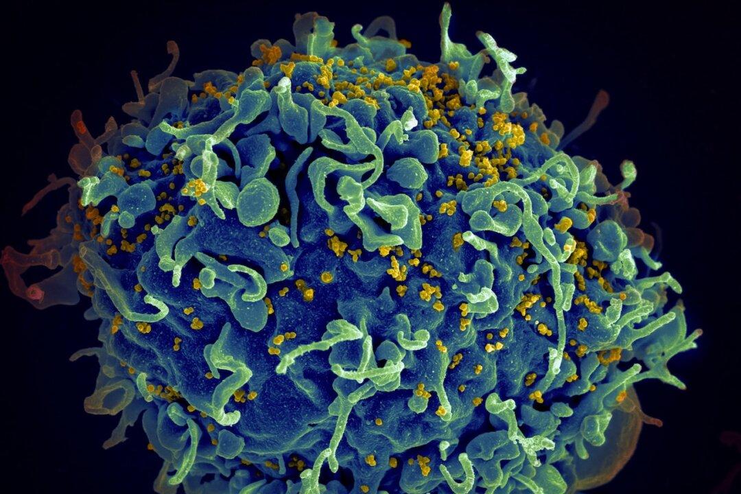 Highly Infectious, More Damaging HIV Variant Found in the Netherlands