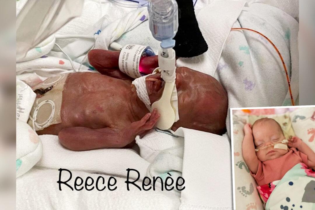 Mom Born With Double Uterus Delivers Hospital’s Youngest Surviving Baby at 22 Weeks