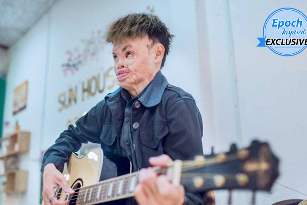 ‘I Am More Than How I Look’: Burn Survivor Goes From Hiding at Home to Opening Bakery