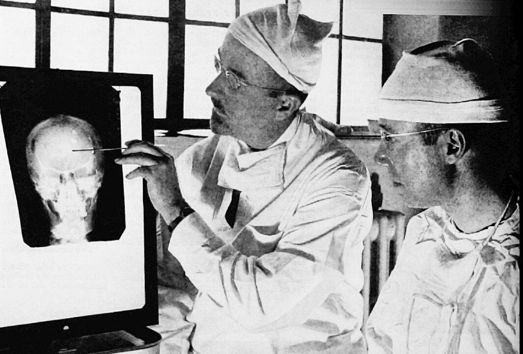 The Sordid Past and Brighter Future of Brain Surgery