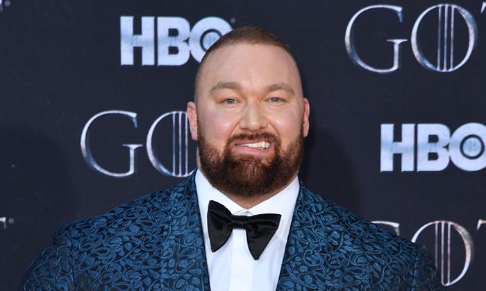 What Is Bell’s Palsy? Migraine Headache May Double the Risk