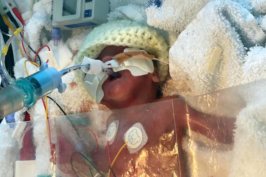 Baby Born 17 Weeks Early Survives After His Parents Refused Twice to Turn Off His Life Support