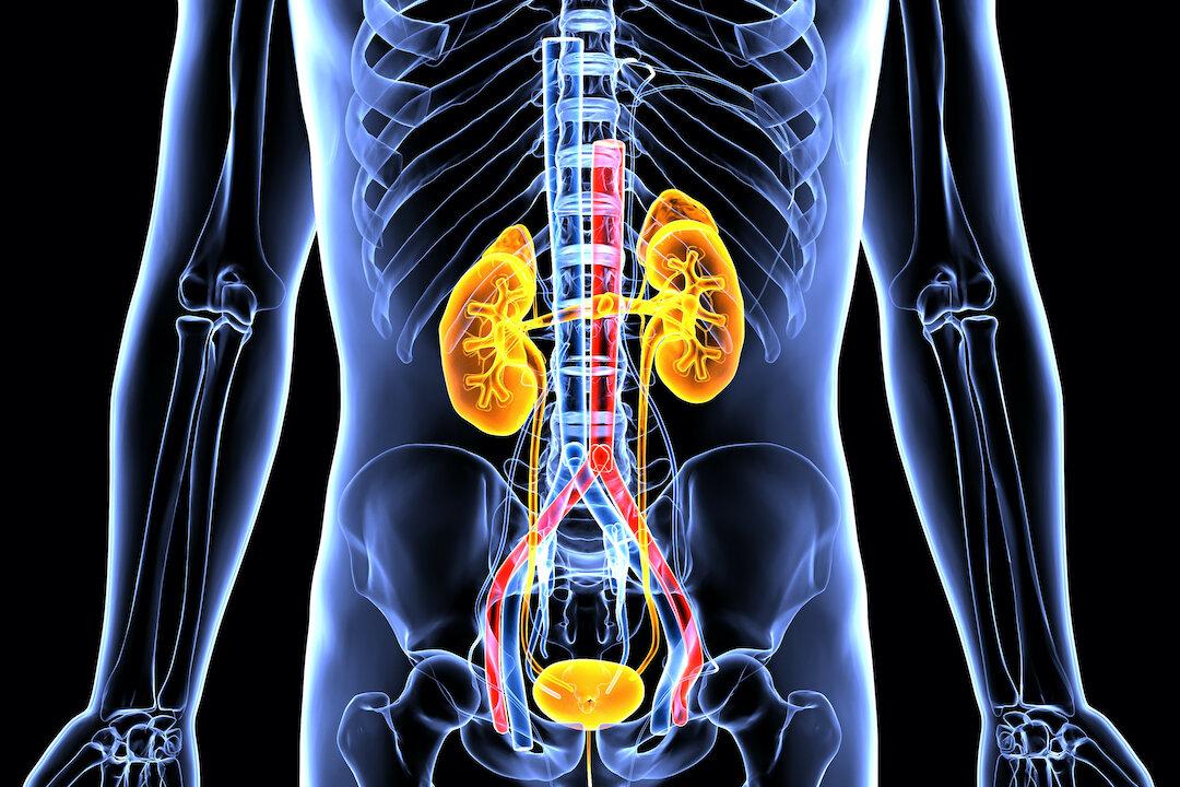 The Excruciating Pain of Kidney Stones: 2 Most Common Types and How to Prevent Them