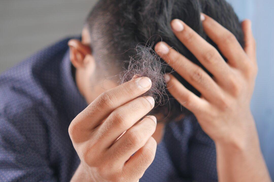 Study Links COVID-19 Infection to Excessive Hair Loss