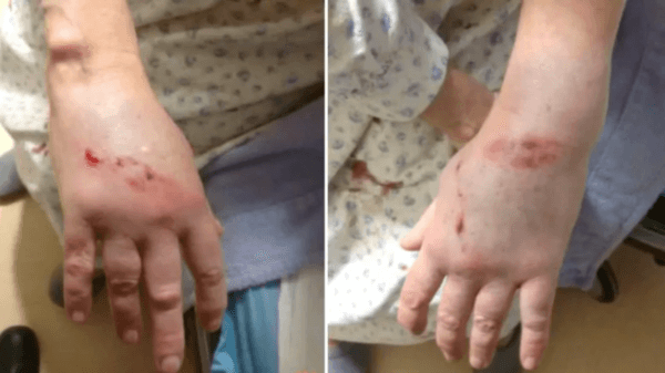 Janet Hamnett was badly beaten in January 2018 by Matthew Brown after he broke into her home. (Court exhibit via The Canadian Press)