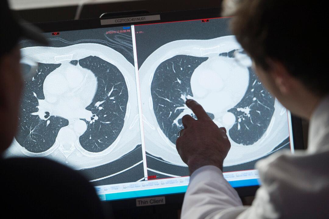 Cancer Causes Quarter of Premature Deaths and Rising: Report