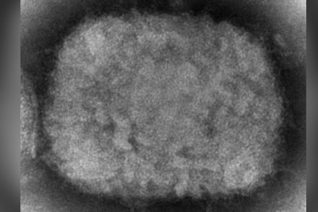 What Is Monkeypox Virus That Is Spreading in Europe, US