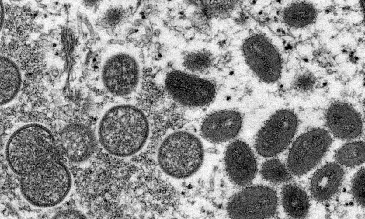 This 2003 electron microscope image shows mature, oval-shaped monkeypox virions (L) and spherical immature virions (R) obtained from a sample of human skin associated with the 2003 prairie dog outbreak. (Cynthia S. Goldsmith, Russell Regner/CDC via AP)