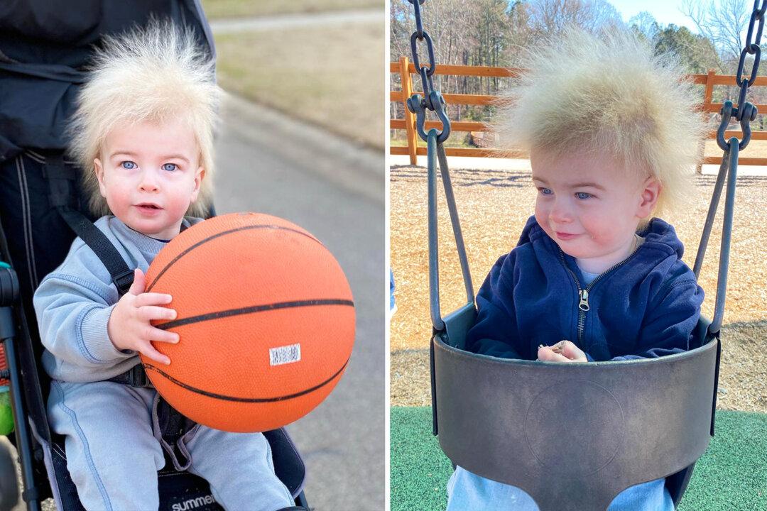 ‘His Hair Is a Blessing’: Boy With Rare Uncombable Hair Syndrome Brings a Smile to Faces