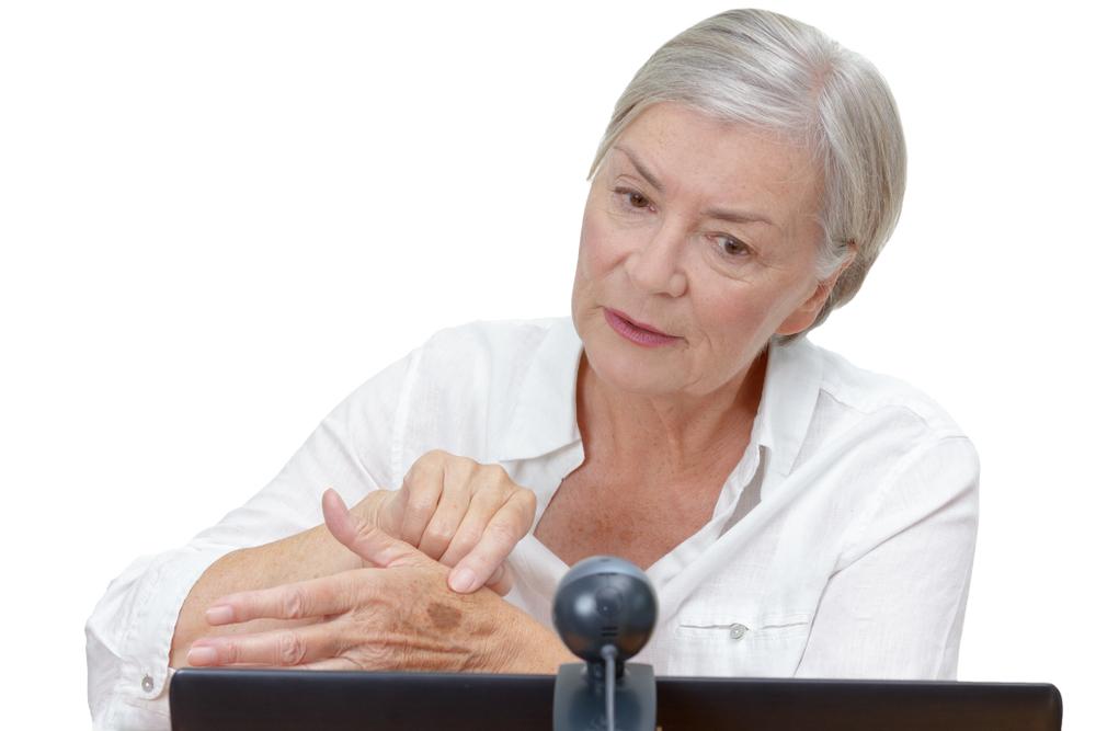 Looking at Liver Spots