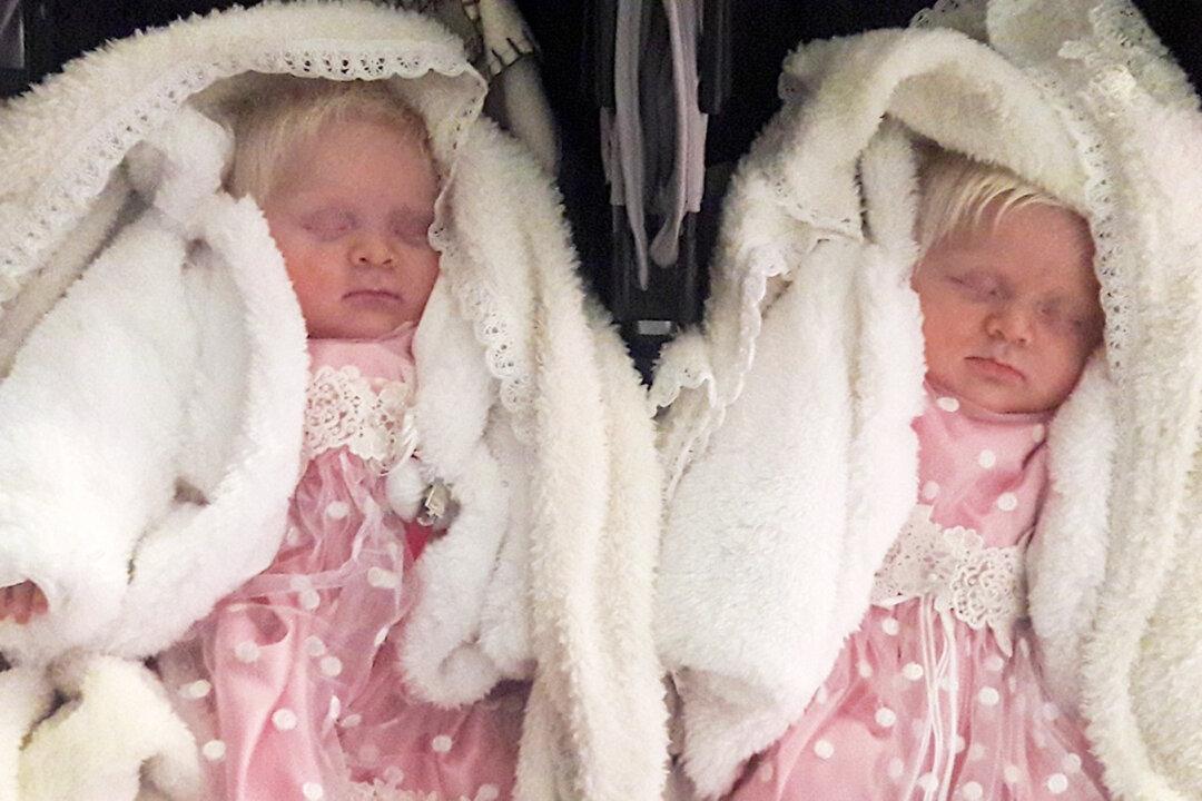 Parents Give Birth to Rare Albino Twins, Share Family Life With Their 4-Year-Old Daughters