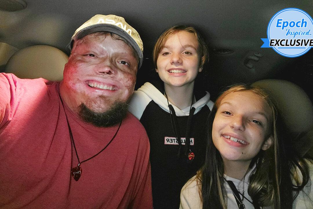 Miracle Survivor of 98 Percent Body Burns Raises 2 Kids, Credits God for Keeping Him Alive