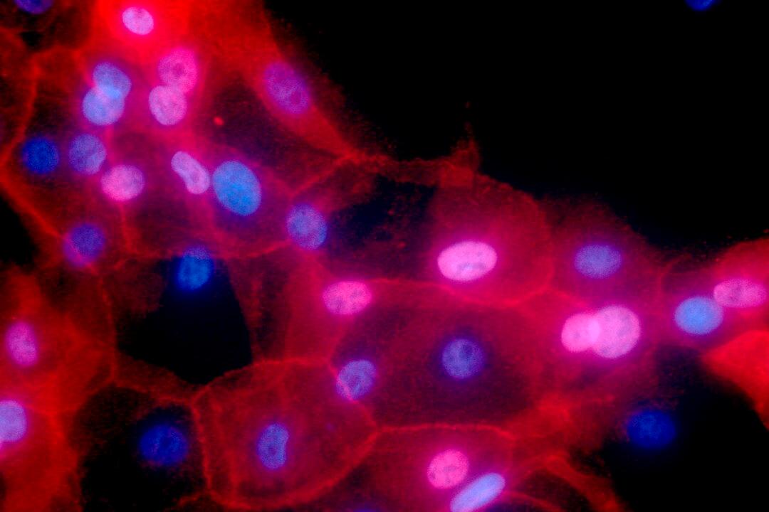 13 Cancers Are Related to This One Physical Condition, and It’s Only Increasing