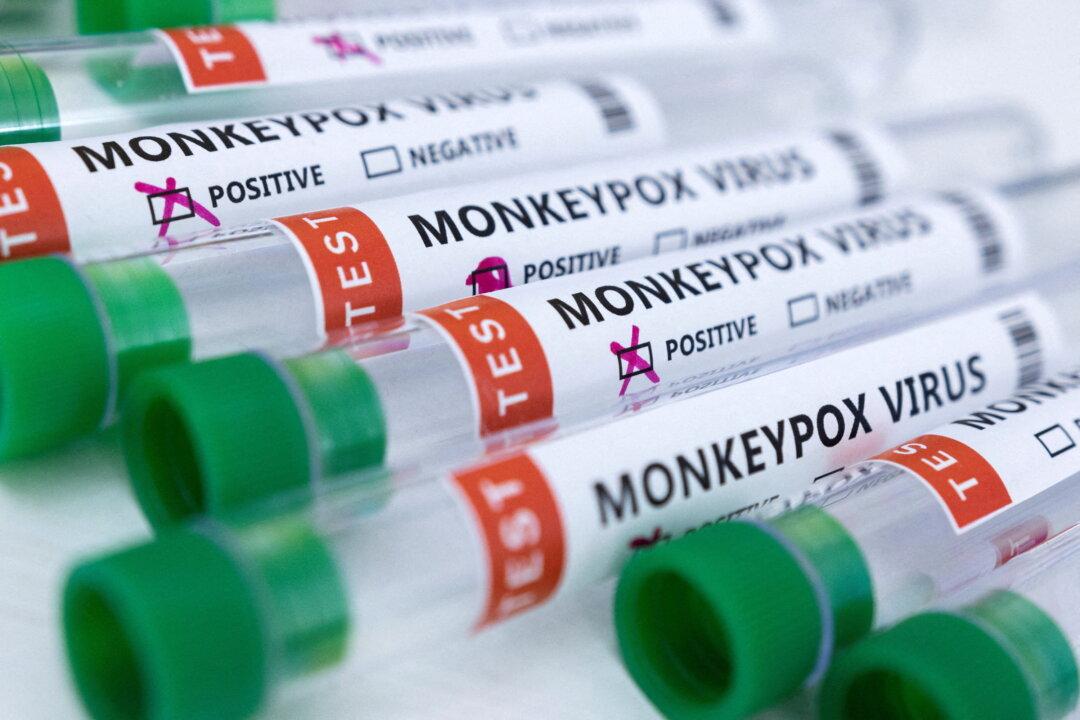 112 Monkeypox Cases Confirmed in Canada, Says Tam