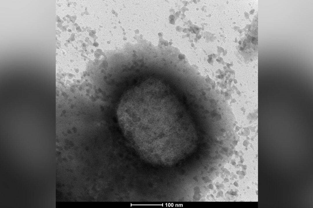 South Korea Confirms First Monkeypox Case, Infections Numbers From Around The World