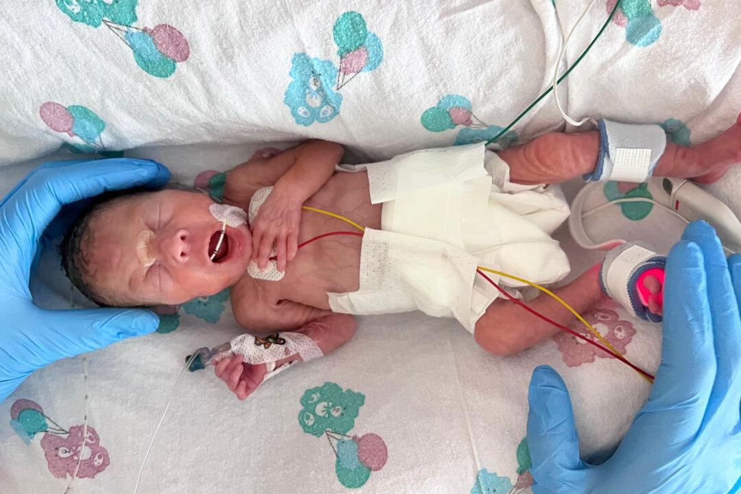 Mom Says Her Preemie Born 14 Weeks Early Is an ‘Absolute Miracle and Complete Perfection’
