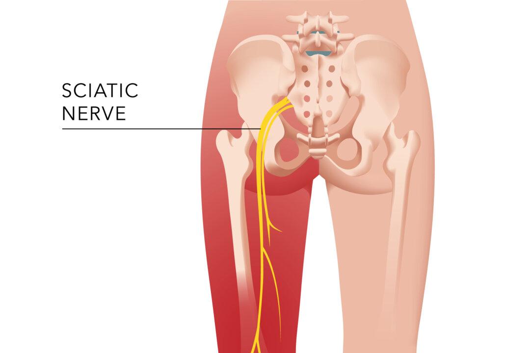 How I Healed My Sciatica