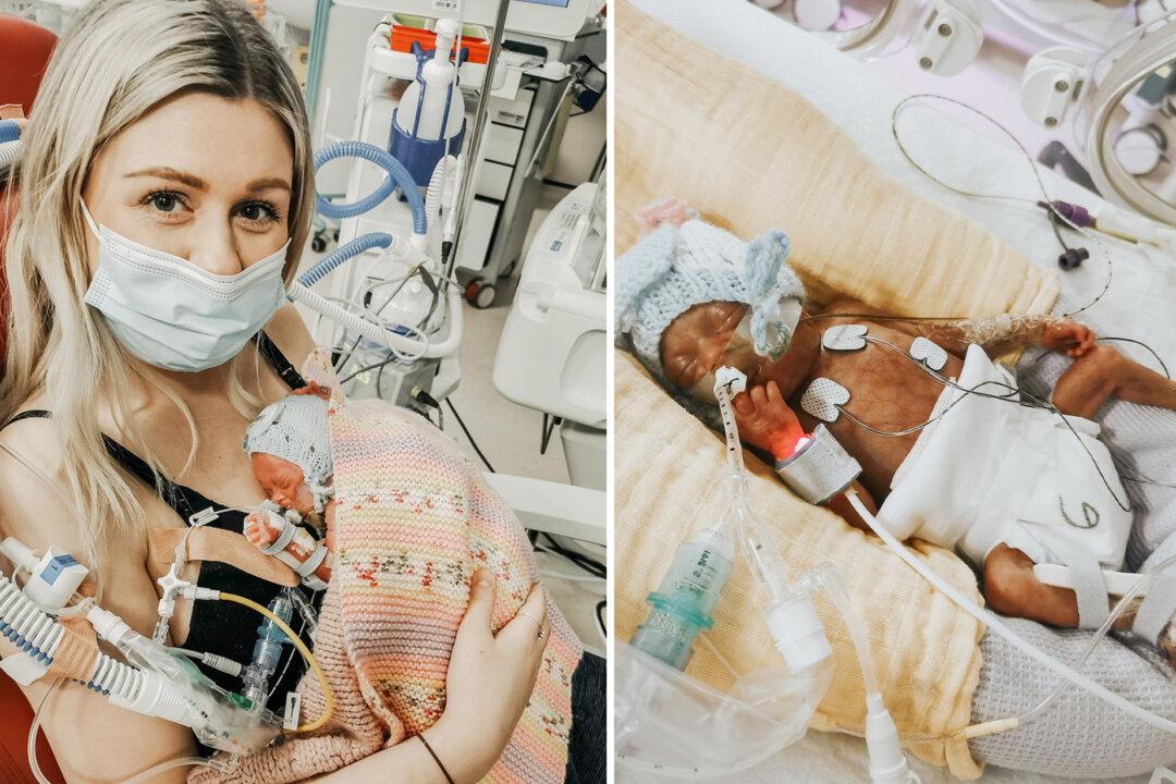 Preemie Born at 23 Weeks and 4 Days Saved by Mom’s Cuddles Defies Odds and Survives