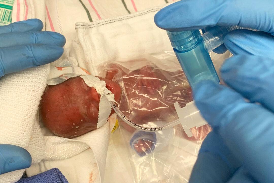 Baby Born at 11 Ounces Smallest to Survive in Hospital’s NICU, Finally Heads Home
