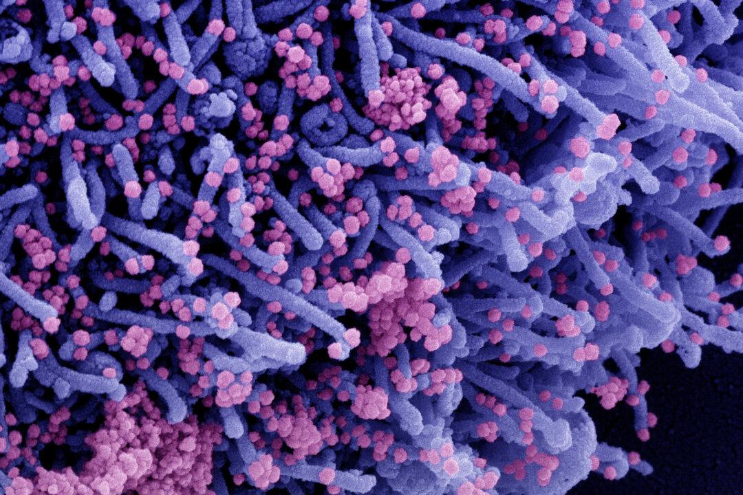 Top Scientist Says Lab Origin for COVID-19 Possible