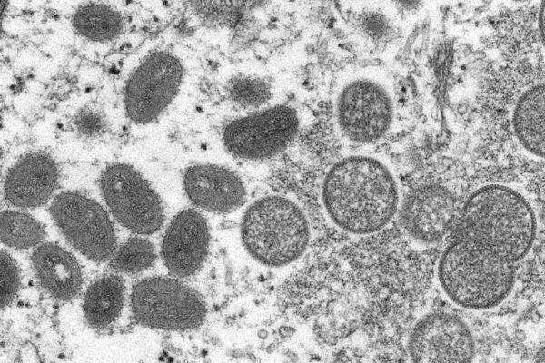 This 2003 electron microscope image made available by the Centers for Disease Control and Prevention shows mature, oval-shaped monkeypox virions (L) and spherical immature virions (R) obtained from a sample of human skin associated with the 2003 prairie dog outbreak. (Cynthia S. Goldsmith, Russell Regner/CDC via AP)