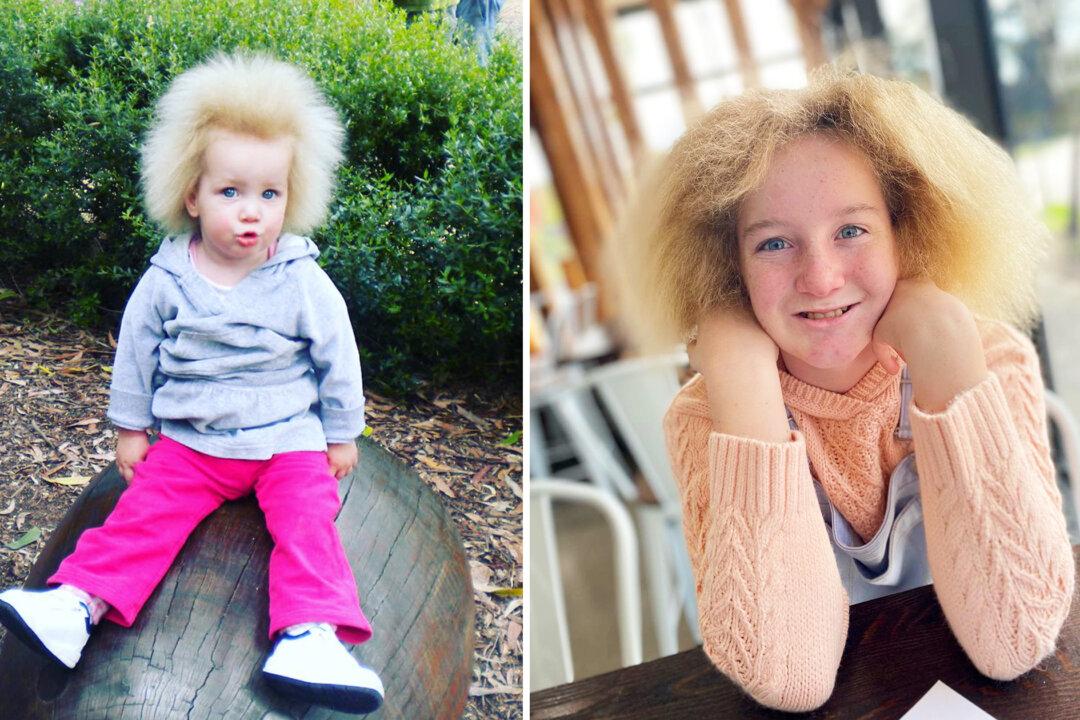 ‘She Is Just Perfect’: Girl With ‘1-in-a-Million’ Hair Disorder Embraces Resilience, Inspires Others