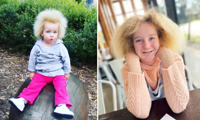 ‘She Is Just Perfect’: Girl With ‘1-in-a-Million’ Hair Disorder Embraces Resilience, Inspires Others