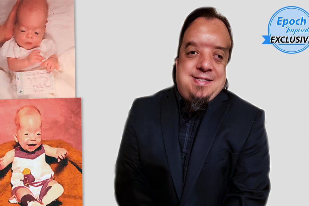 ‘God Created a Brain in My Head’: Boy Born Without a Brain Gets Healed, Inspires Others Toward Faith