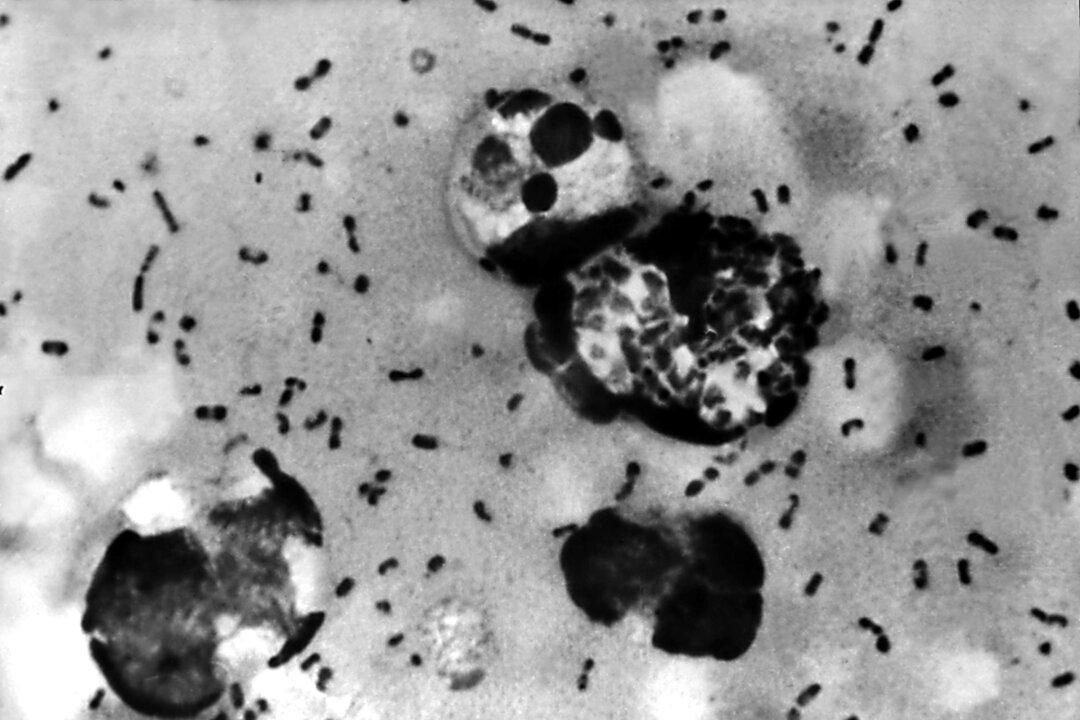 China Reports One Human Infection of Bubonic Plague in Northwestern Region of Ningxia