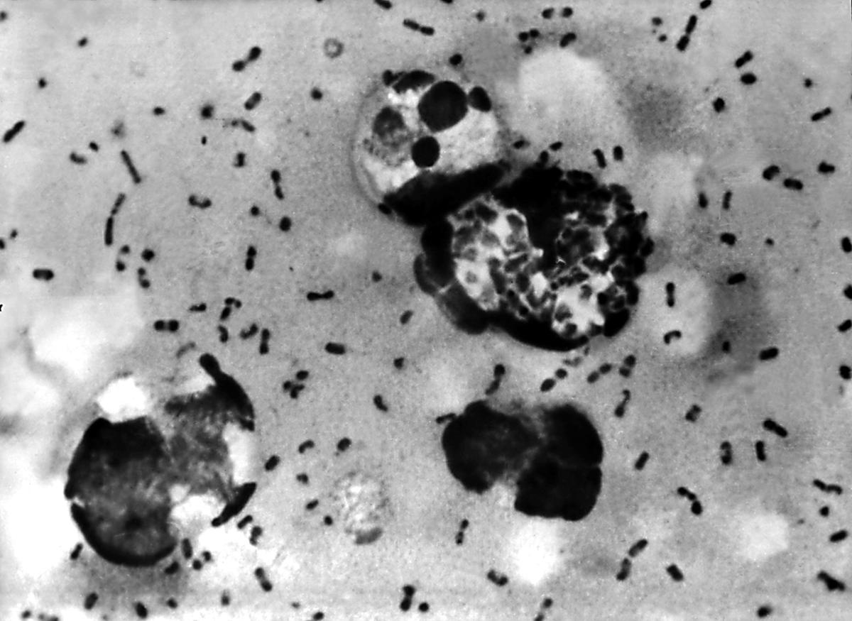 China Reports One Human Infection of Bubonic Plague in Northwestern Region of Ningxia