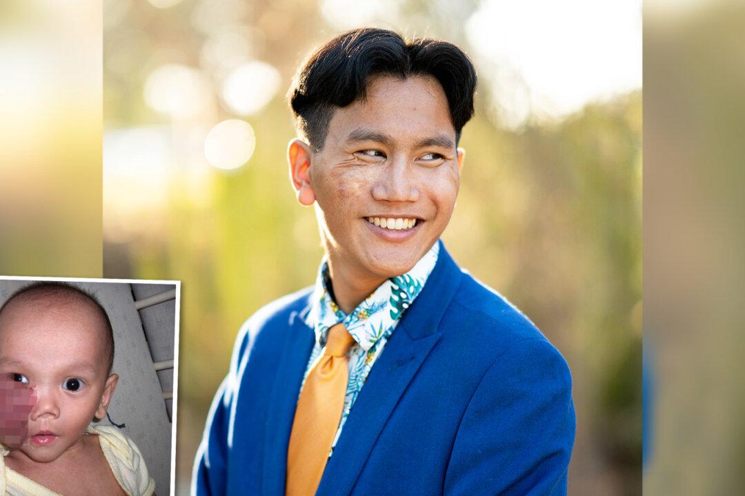 Vietnamese Baby With Facial Tumor Gets Adopted in the US, Reunites With Birth Parents at 18