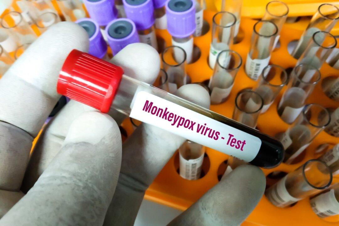Monkeypox Virus: Facts Vs Fear