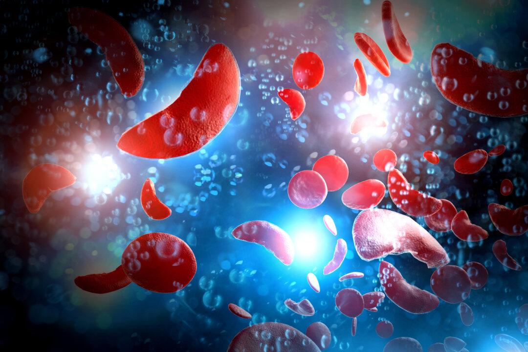Sickle Cells Get Tripped up by Sticky Ones