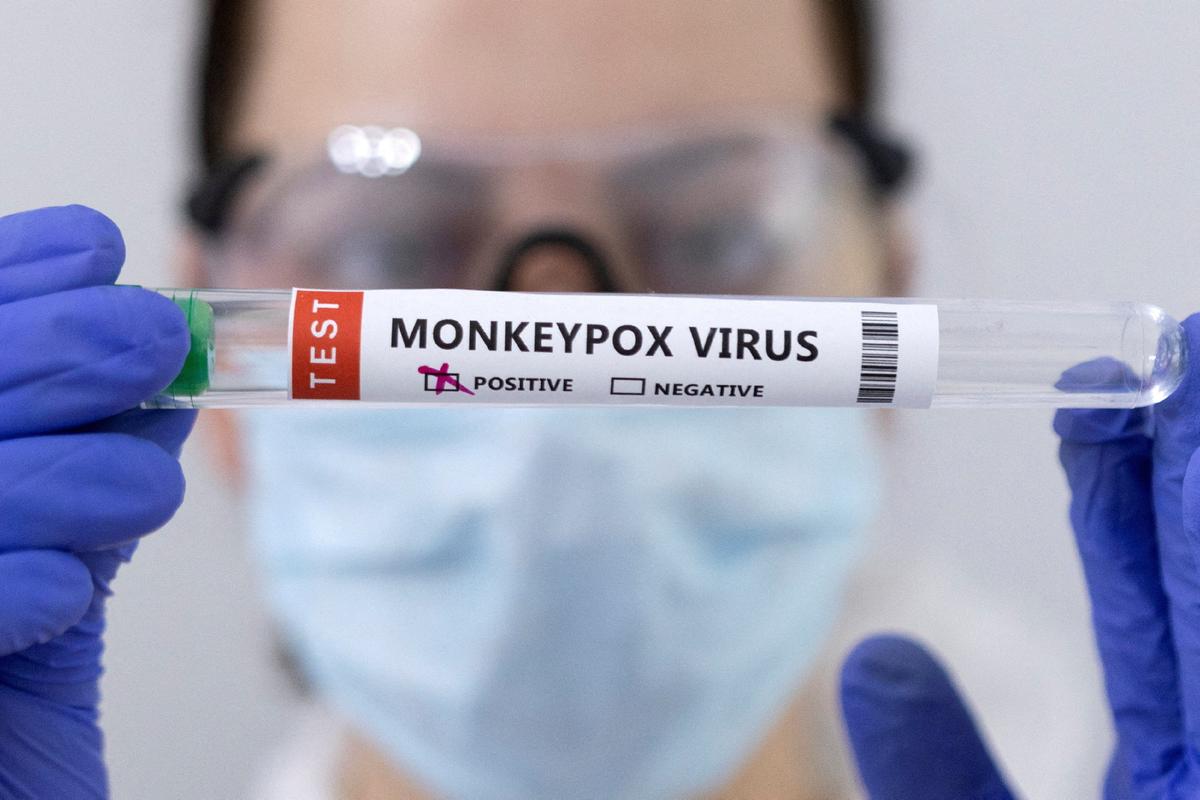 Growing Evidence Indicates Sex Between Men Is Fueling Monkeypox