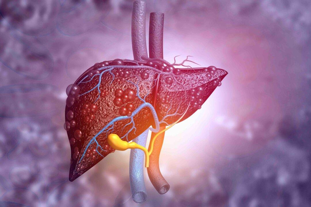 Eating Fast Food Regularly Is Linked to Liver Disease: Study