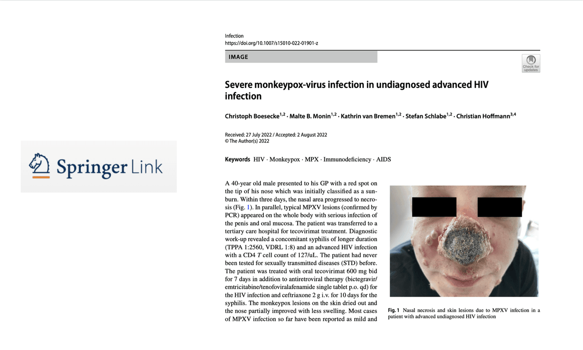 Man With Monkeypox Had Nose Decay and Abscesses All Over His Body