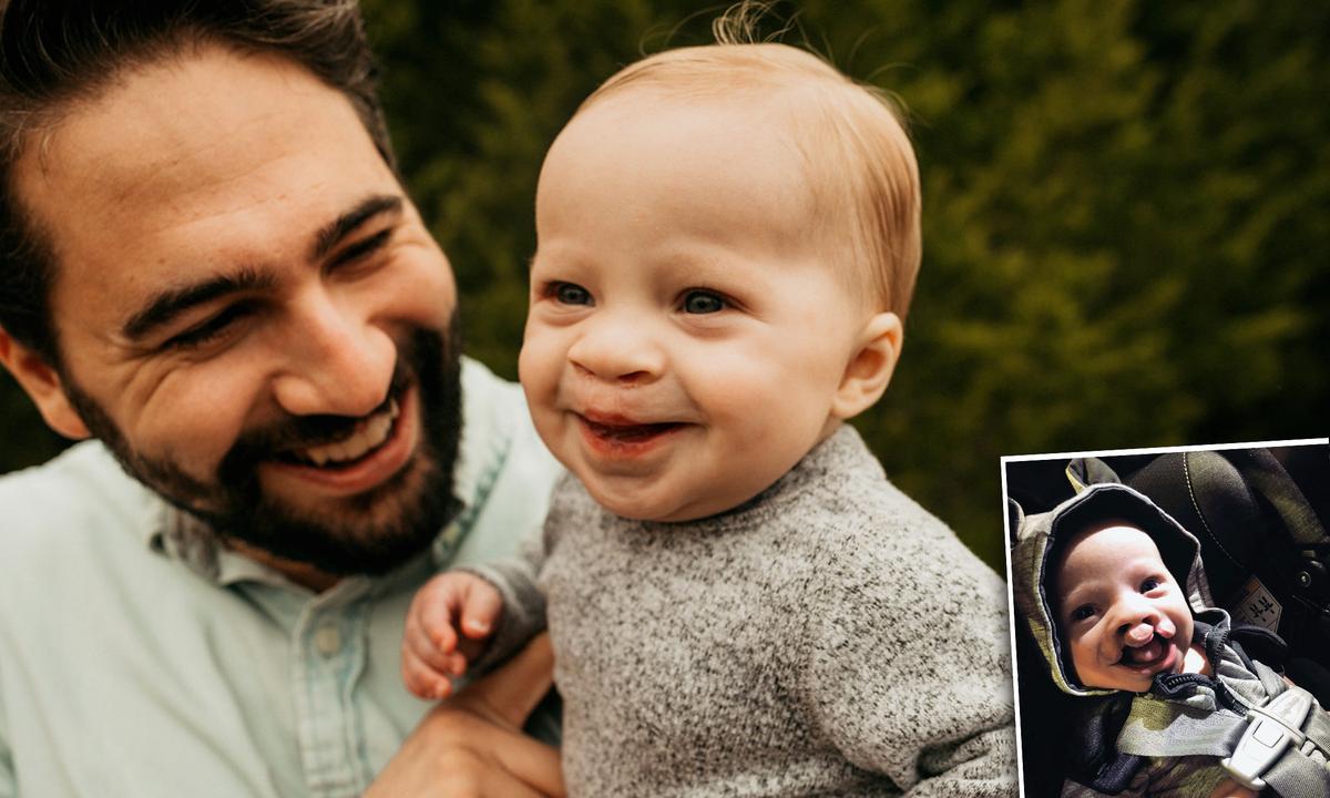Dad Shares Son’s Story After Friend Comments That a Baby With Cleft Lip Should Be Aborted