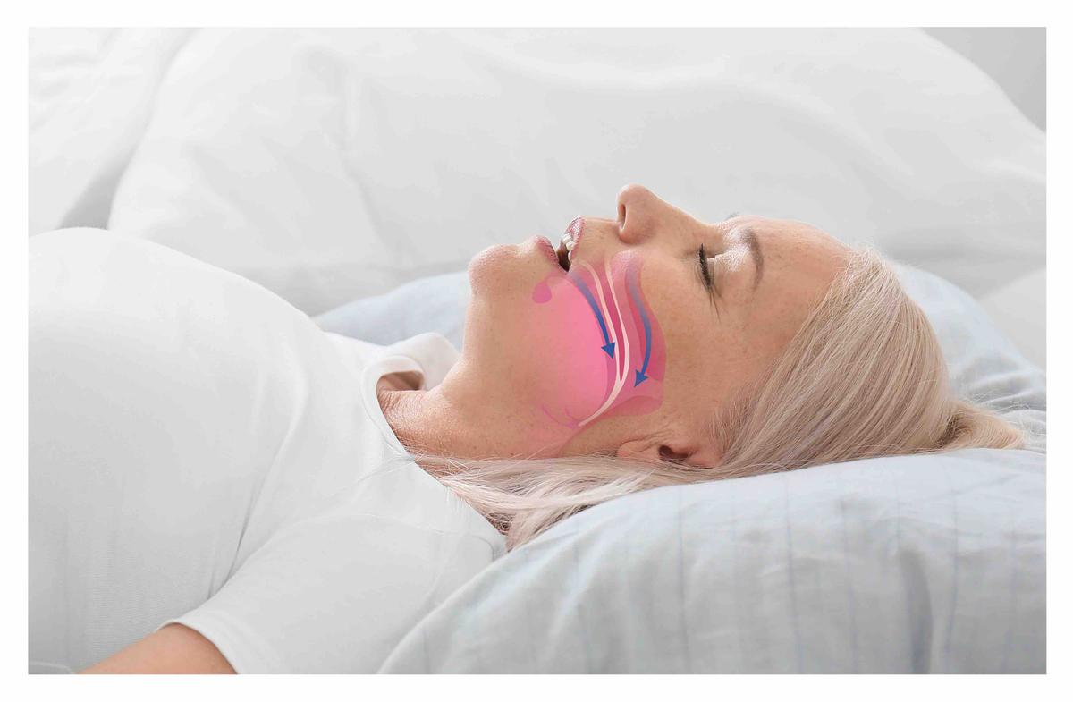 How Does Sleep Apnea Work?