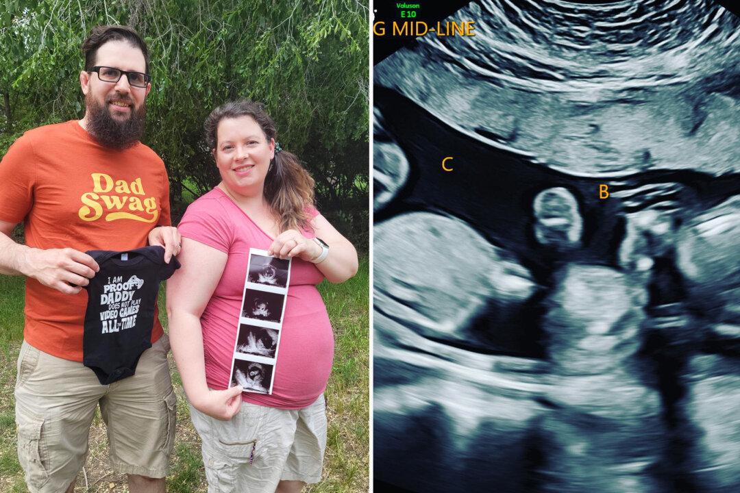 Shocked Couple Are Expecting Rare, Naturally Conceived ‘One in 100,000’ Identical Triplets