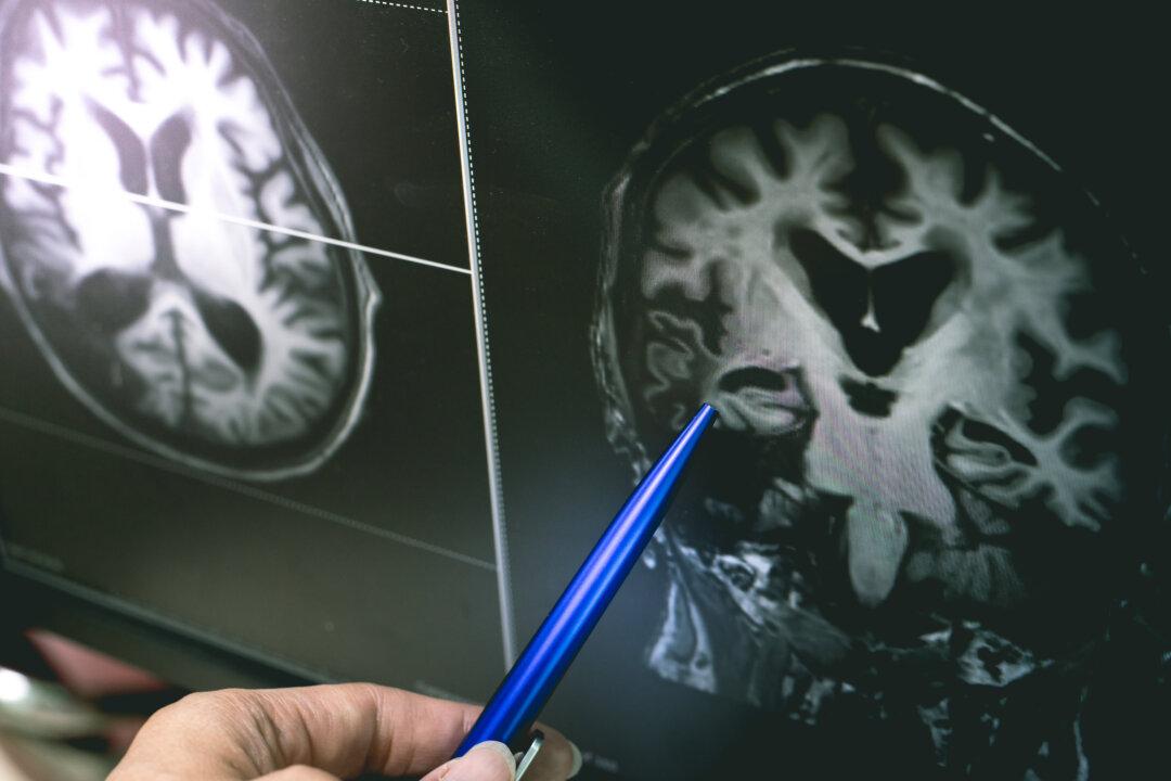 Low Cholesterol May Raise Your Alzheimer’s Risk